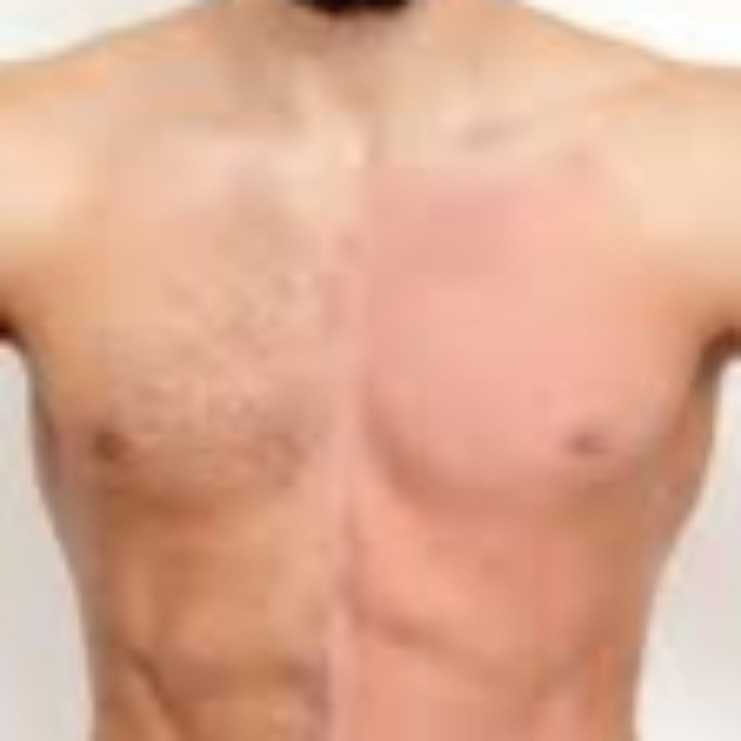 Chest Wax