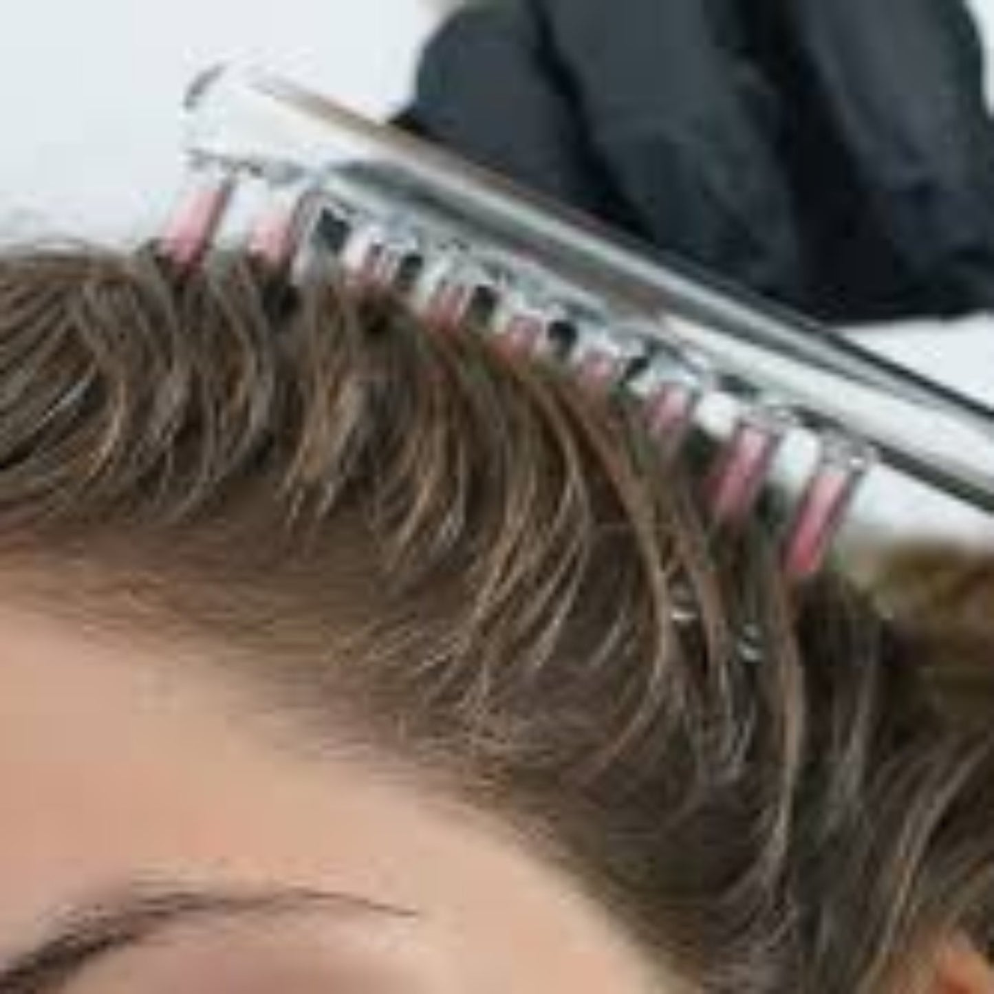 Stimulating Scalp Treatment